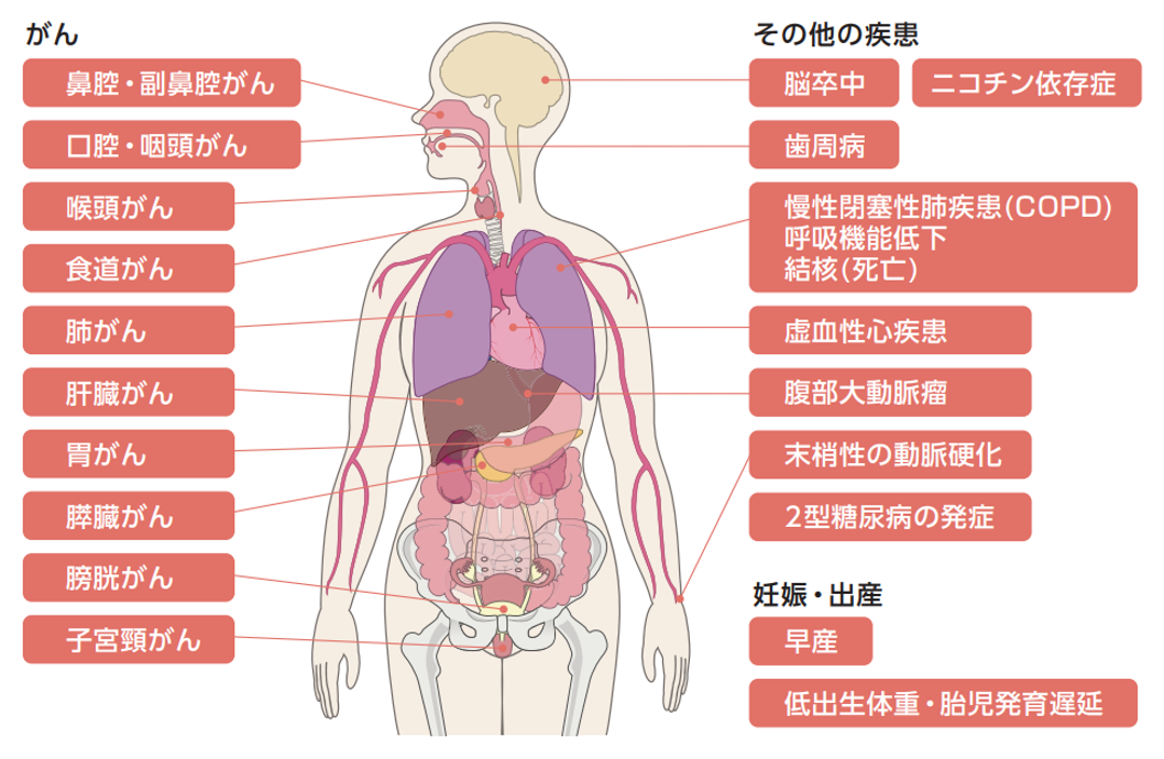 たばこを吸っている本人はこんな病気になりやすくなる